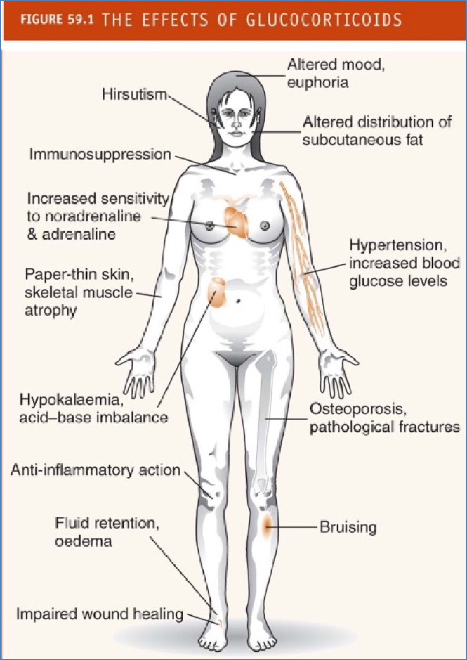 Glucocorticoids side effects