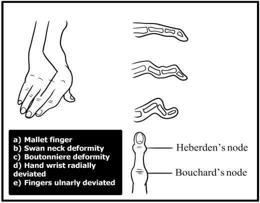 Hand exam - inspection