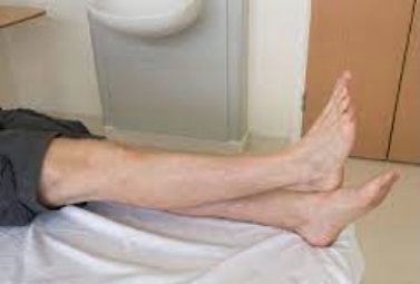 the neurological examination: Heel-Shin Test