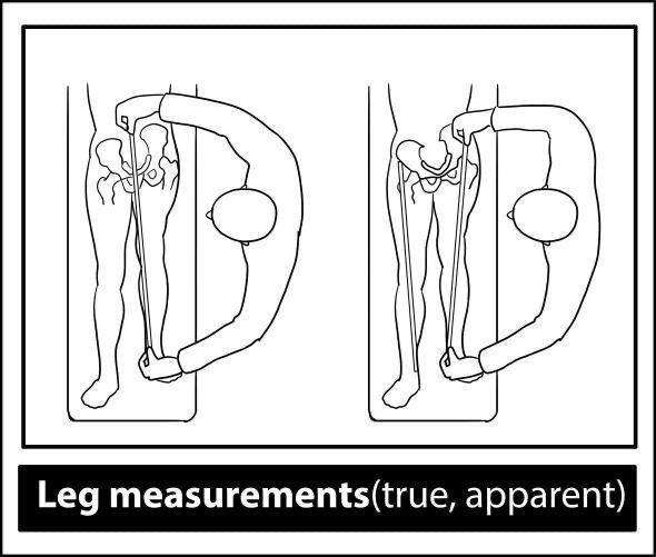 Hip Exam - Leg length measurement