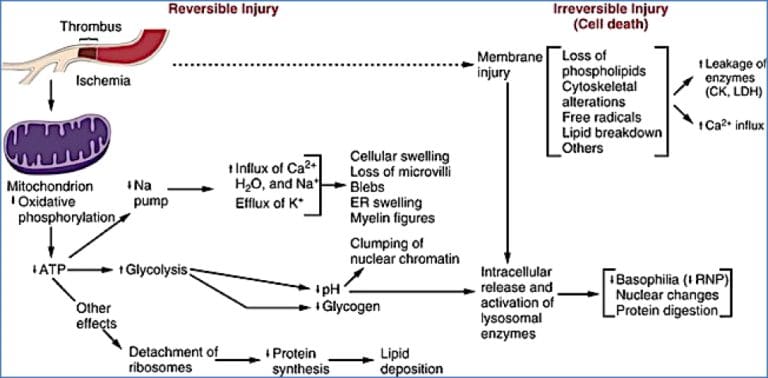 Cell Injury and Death | Cell Biology | MedStudentNotes