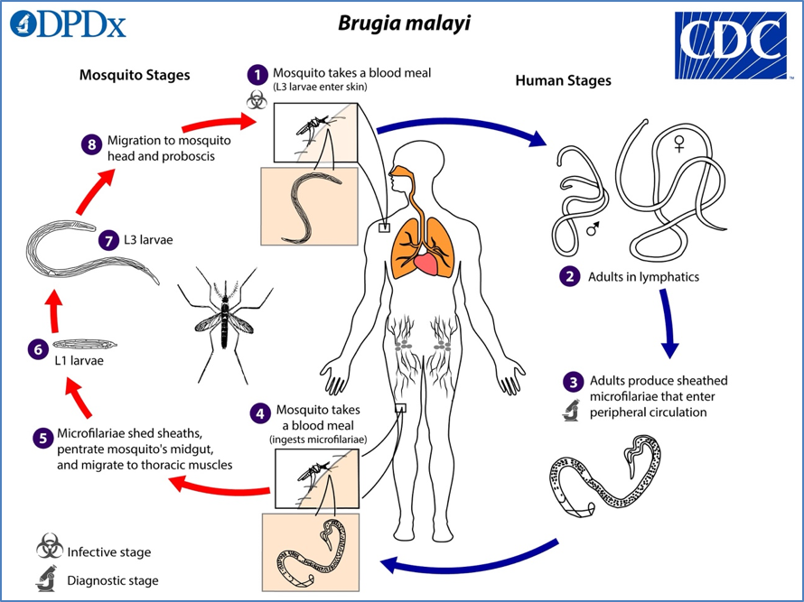 LYMPHATIC FILARIASIS