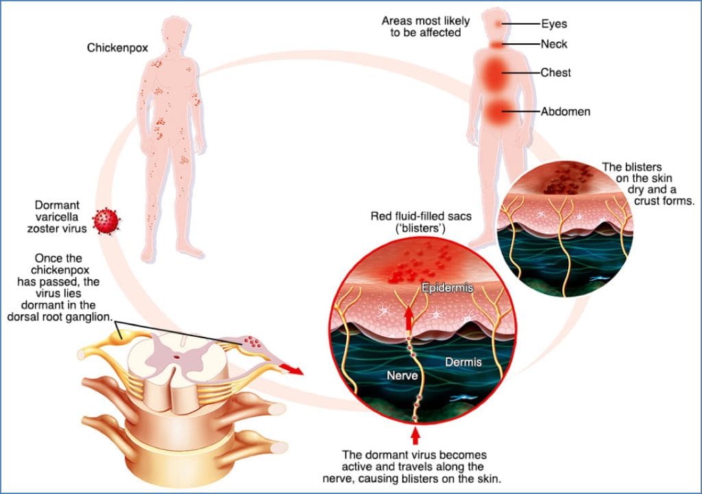 pathogens & immunity: Latency