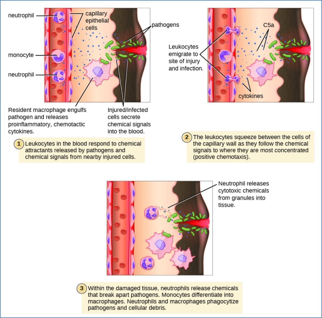 inflammation: Leukocyte Migration