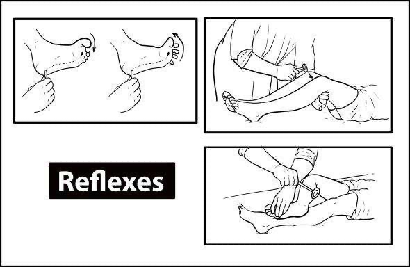 Lower Limb Neurological Examination - Reflexes