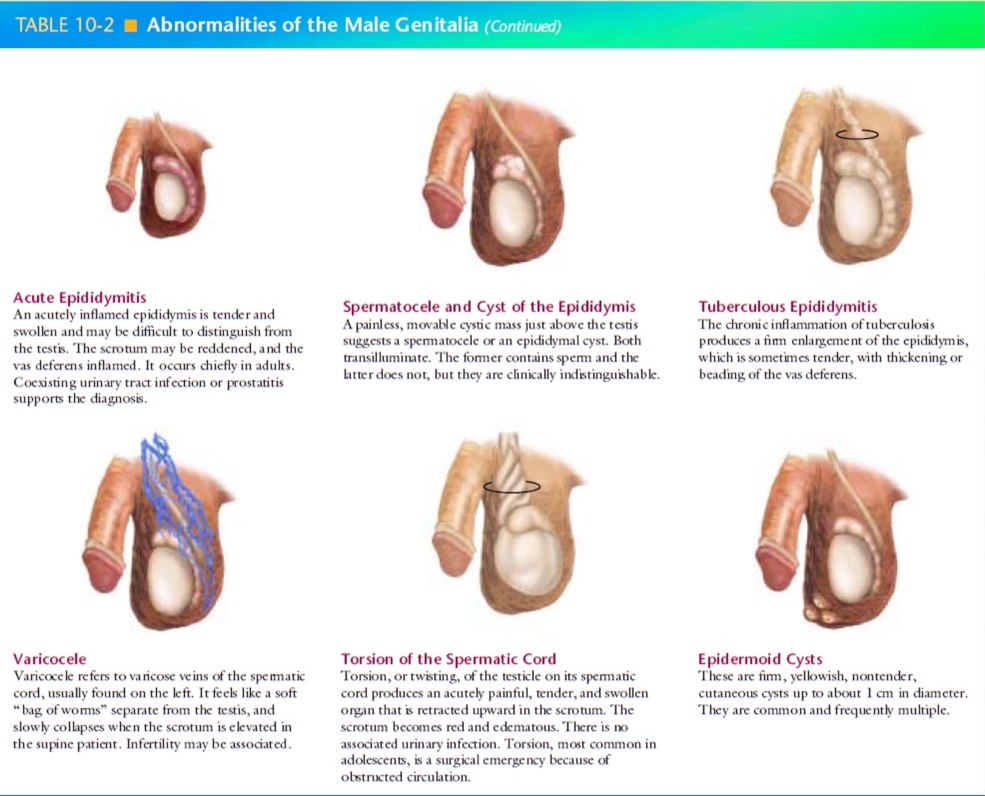 male genital exam: Abnormalities of the scrotum