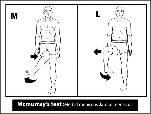 Knee Examination OSCE Prep MedStudentNotes