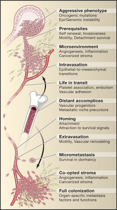 Neoplasia: Metastasis