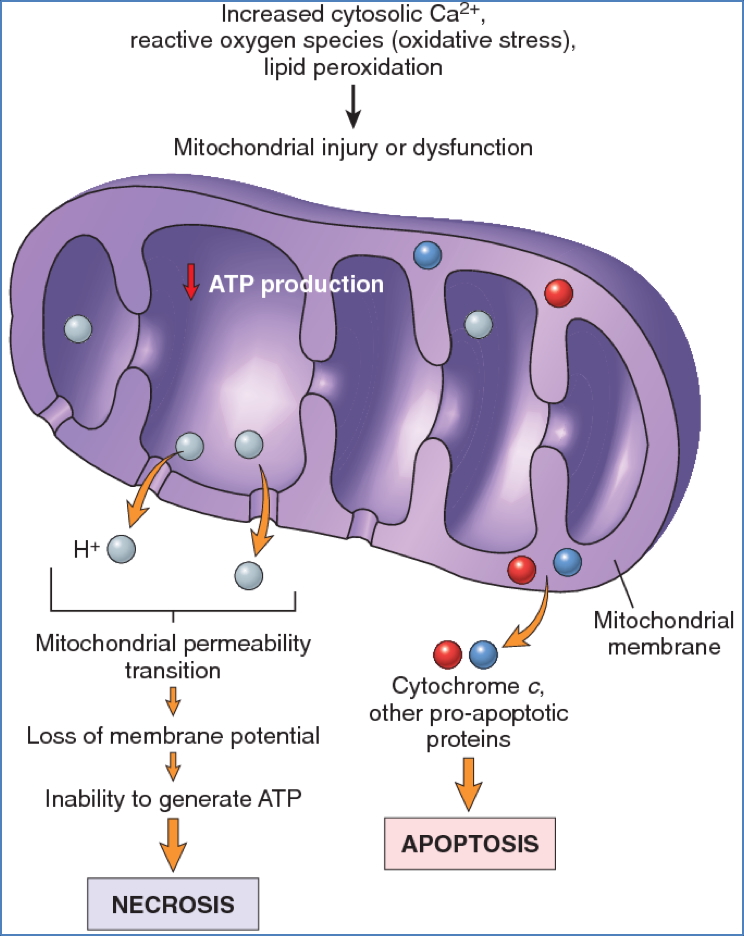 Cell Injury and Death - Mitochondrial Damage