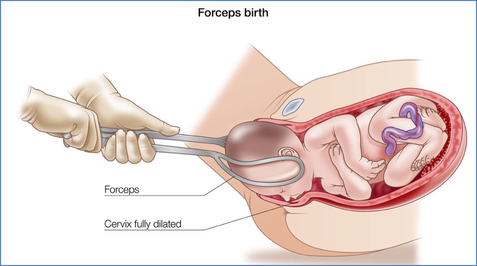 OPERATIVE OBSTETRICS