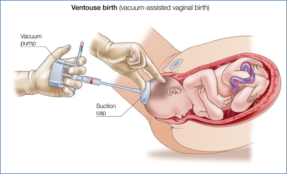 OPERATIVE OBSTETRICS