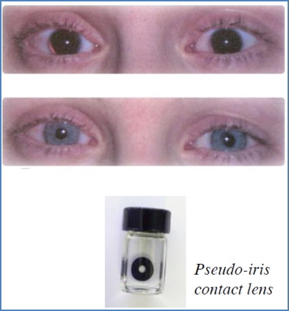 Organogenesis – Master Control Genes