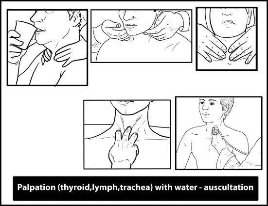 Thyroid Palpation & auscultation