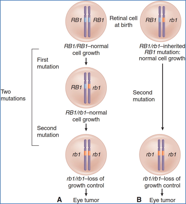 Knudson’s 2-Hit Hypothesis for Tumour-Suppressor Genes