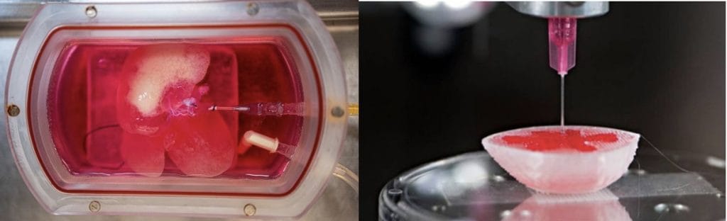 future genetic therapies: Tissue engineering