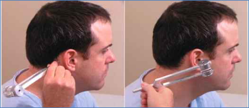 ear examination guide: Rinne Test