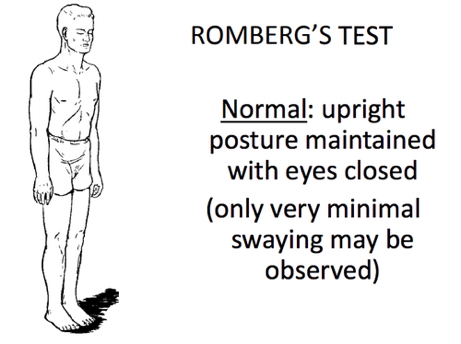 the neurological examination: Romberg’s Test