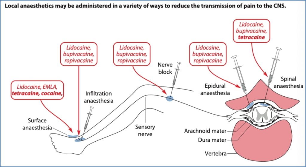 Local Anaesthetic Routes of Administration