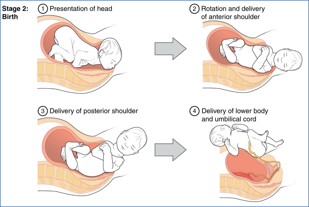 Stage 2- Expulsion Stage