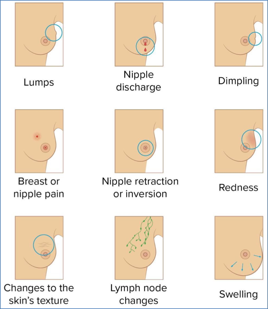well-woman check: The Breast Examination