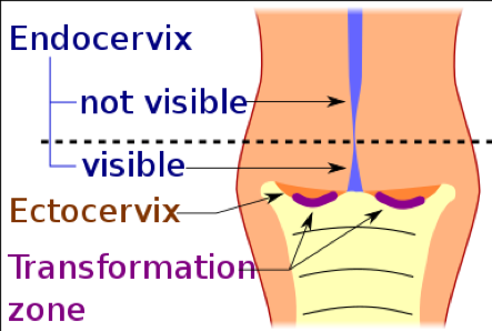 The Transformation Zone
