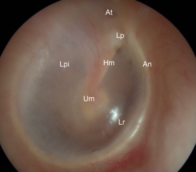 The Tympanic Membrane