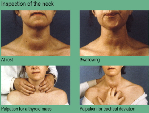 the endocrine examination: Thyroid Gland Examination