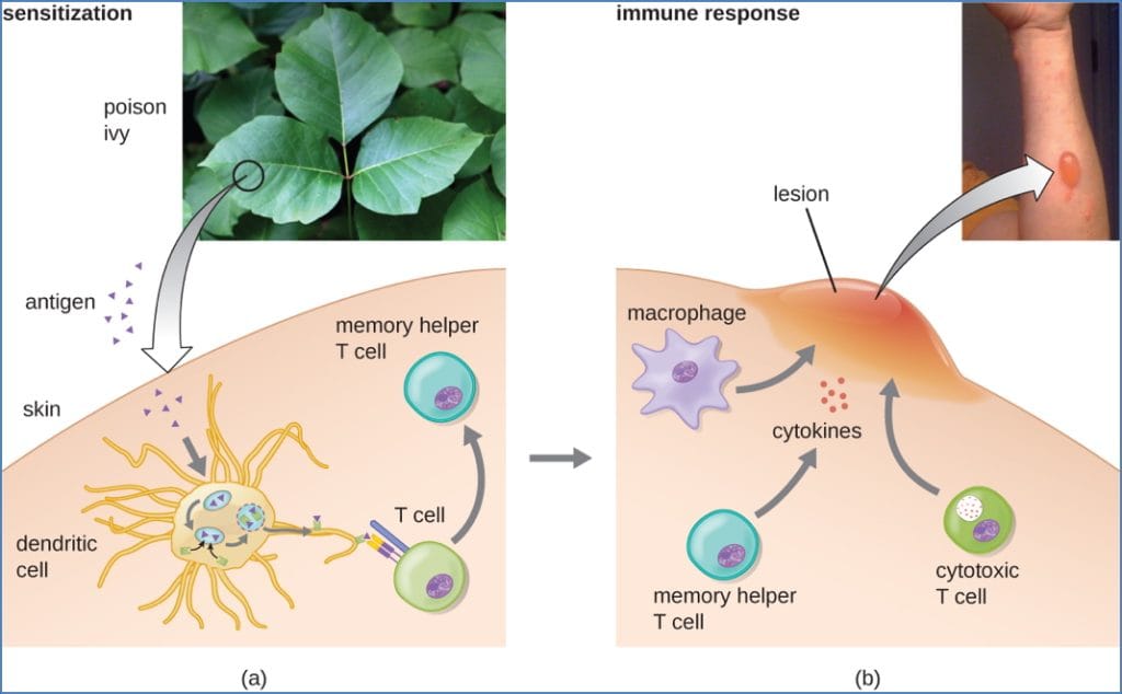 Type-IV Hypersensitivity
