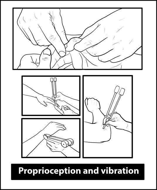 Upper Limb Neurological Examination - Proprioception & Vibration