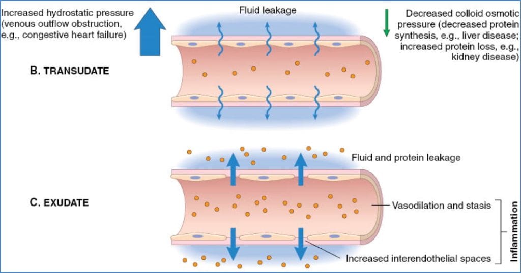 inflammation: Vasoactivity
