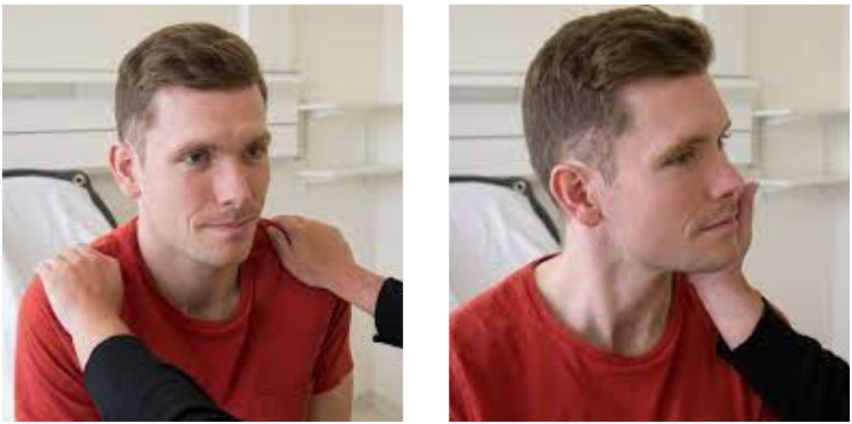 XI – Accessory Nerve